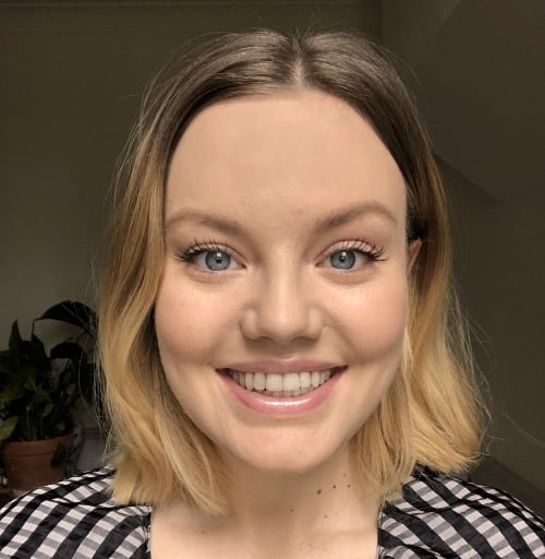 invisalign smileview after, stomatološka ordinacija mondent