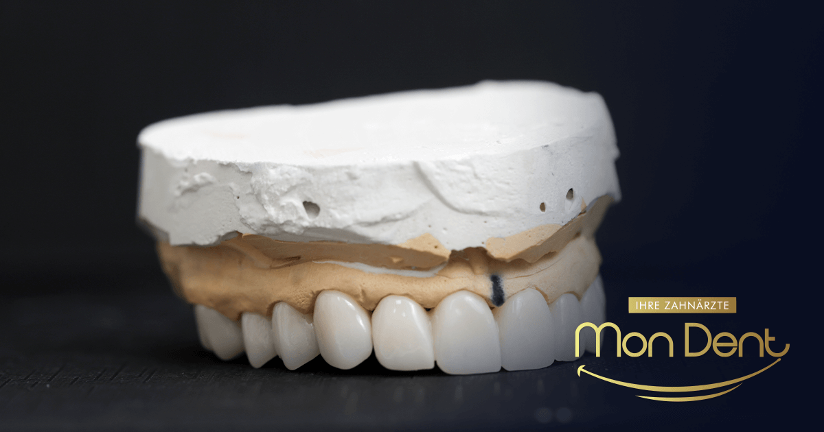 Implantation bei Patienten mit Knochendefizit