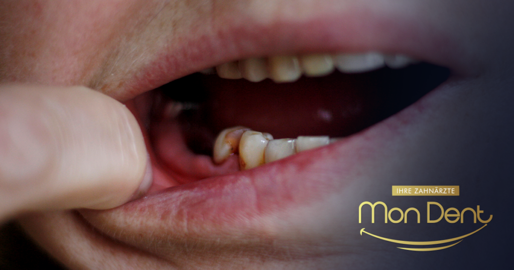 cancrena dentale, studio dentistico